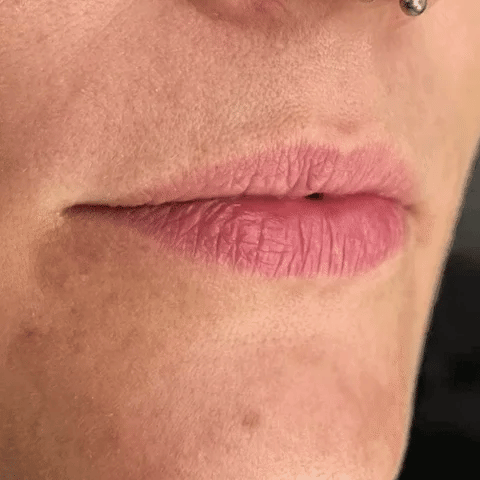 Voluminizador de Labios - Lip Maximizer™ (Oferta 2x1) – DropZone